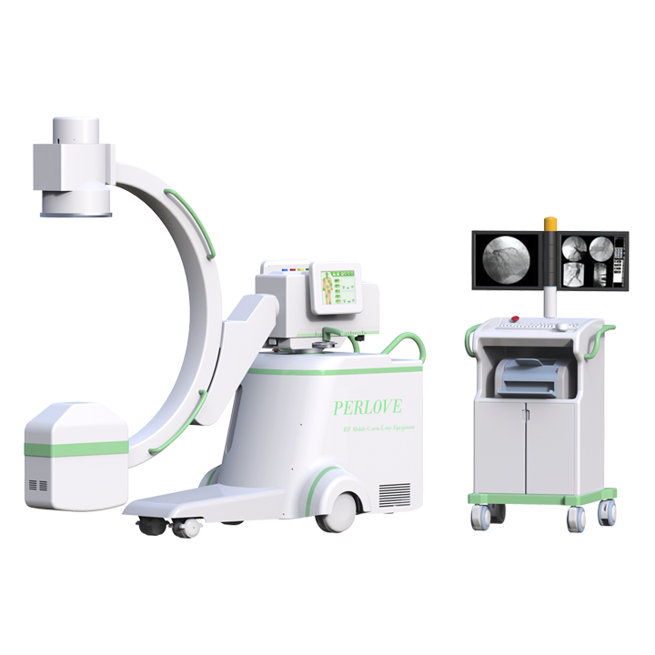數字化醫用c臂機檢查效果