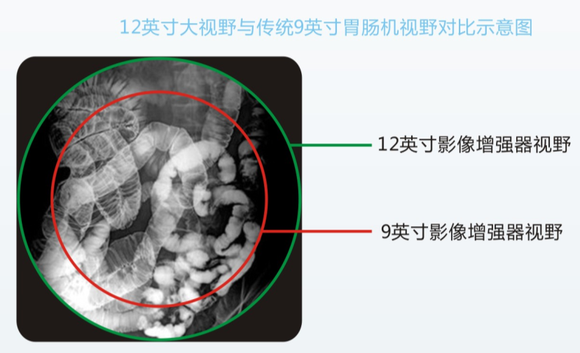 數(shù)字胃腸機優(yōu)勢與檢查效果