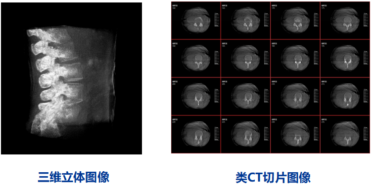 三維C臂圖像