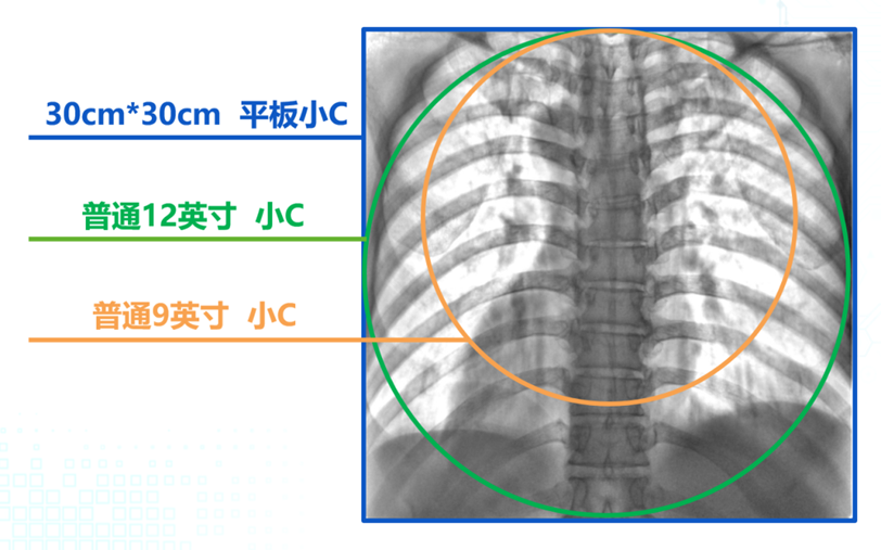 C形臂圖像