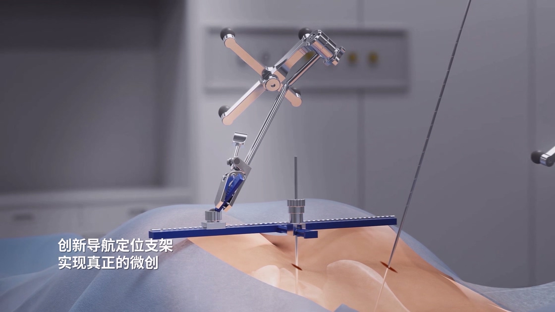 骨科手術(shù)機器人導航定位支架